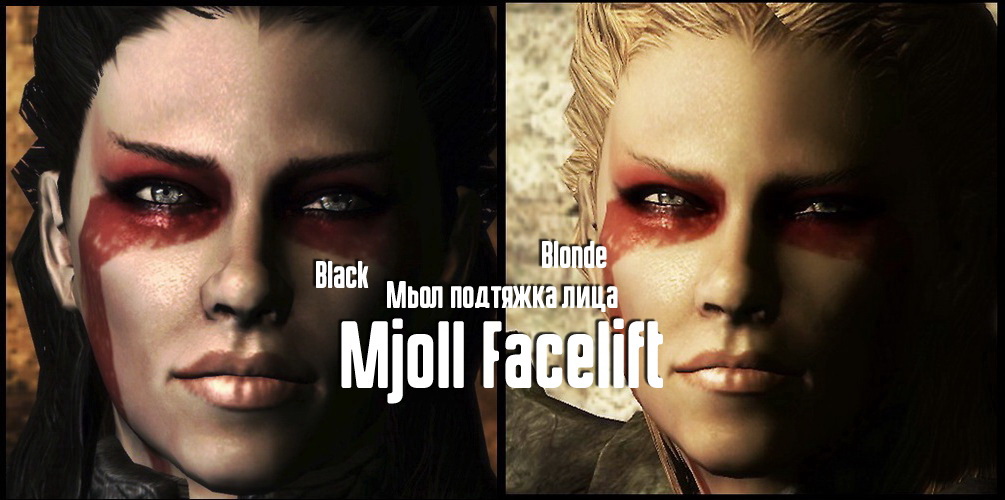 Мьол подтяжка лица / Mjoll Facelift