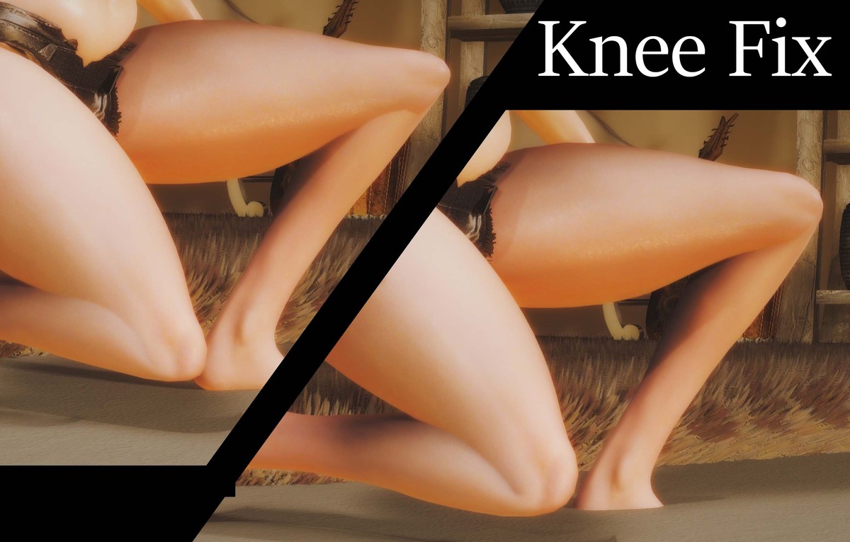 Фикс колена SE-AE | Knee Fix SE-AE